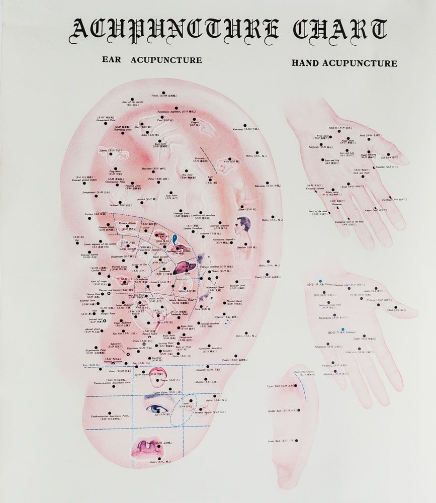 Ohrakupunktur nach Dr. Paul Nogier (1908-1996)